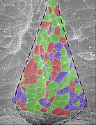 Nuclei with cilia: cells with one cilium are green, cells without cilium are red and cells with abnormal cilia orientation are violet.