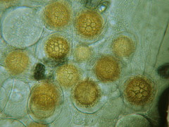 Unterm Mikroskop: Peronospora auf Hornkraut