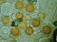 Unterm Mikroskop: Peronospora auf Hornkraut